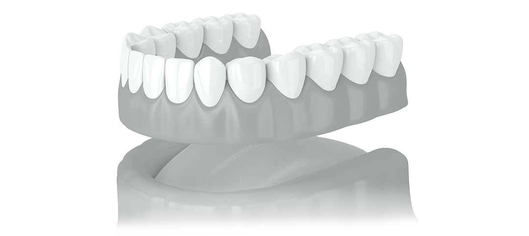 zahnersatz-moeglichkeiten-zahnarzt-dortmund-derne-herausnehmbarer-zahnersatz-vollprothese
